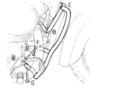 Honda VT 750 C2 [1997-2001] - barre de protection des moteurs-1